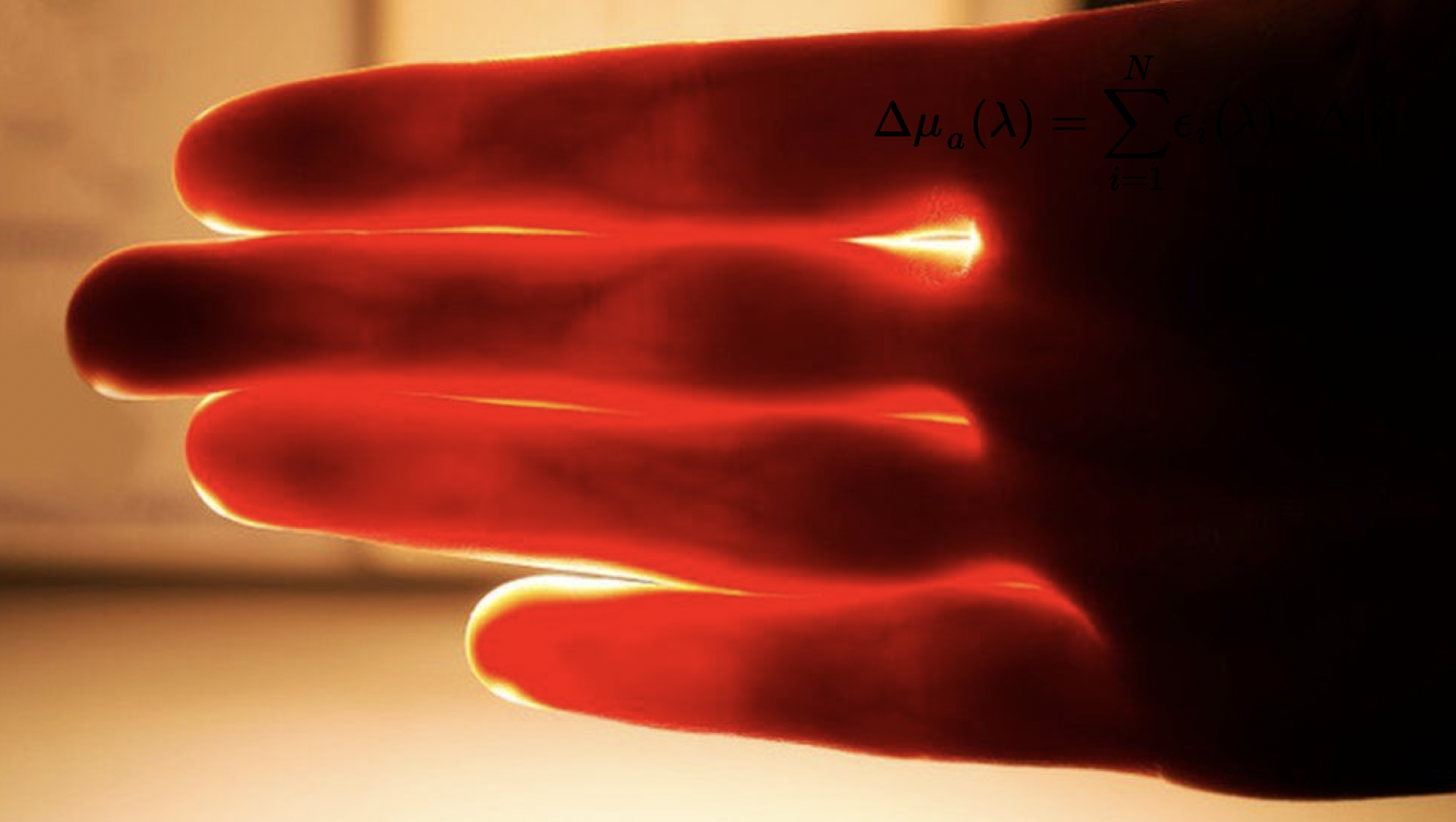 Near-infrared transillumination of the hand